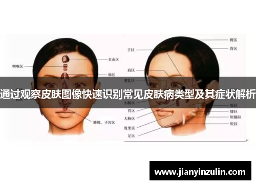 通过观察皮肤图像快速识别常见皮肤病类型及其症状解析