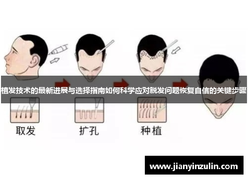 植发技术的最新进展与选择指南如何科学应对脱发问题恢复自信的关键步骤